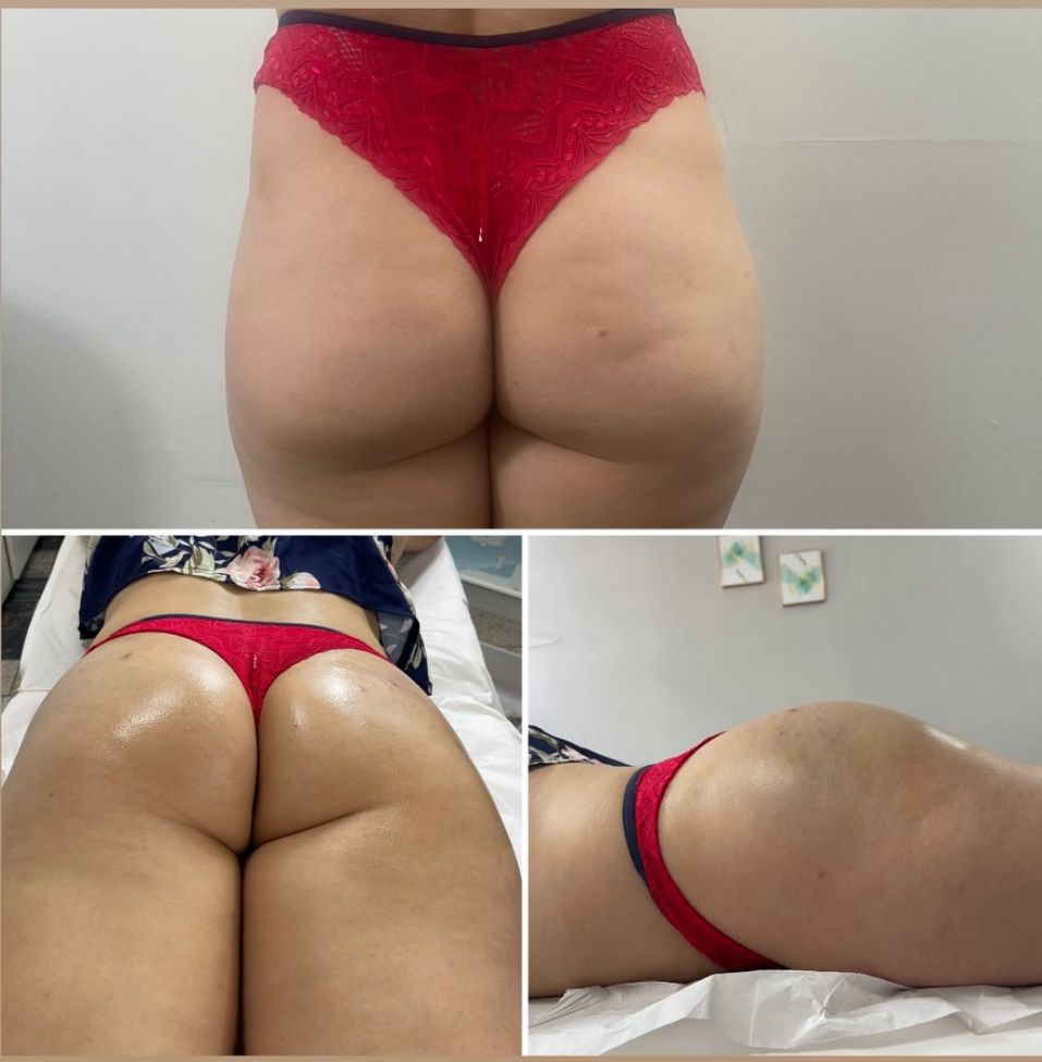 Resultado antes e depois